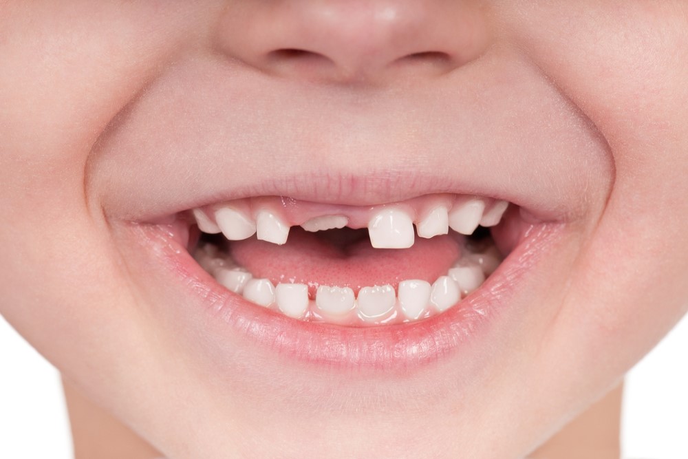 visita ortodontica da bambini